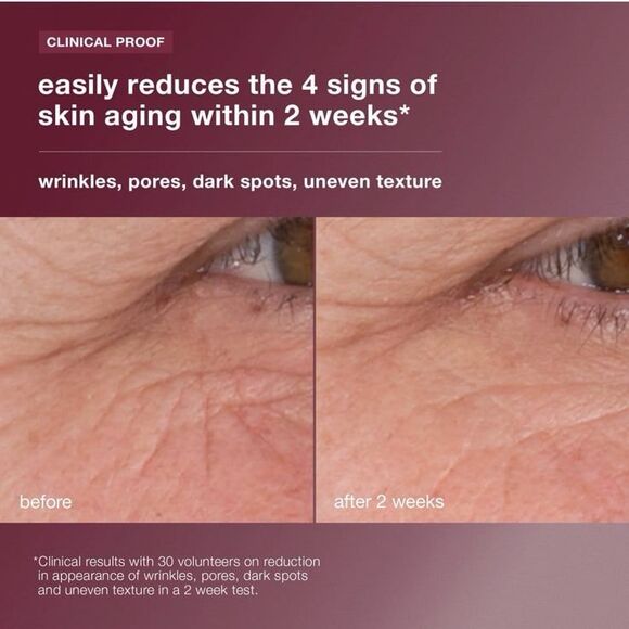 BNIB Dermalogica Dynamic Skin Retinol Serum Antiaging Retexturizing Mini .34 oz - Picture 6 of 12